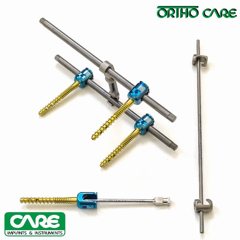 Система для транспедикулярної фіксації хребта (4 фенестрованих поліаксіальних гвинта Ф 5.5 х 45 мм.) ORTHO CARE